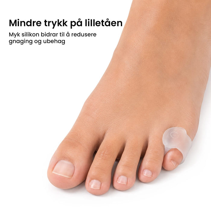 Tåseparator for lilletå (2 stk)