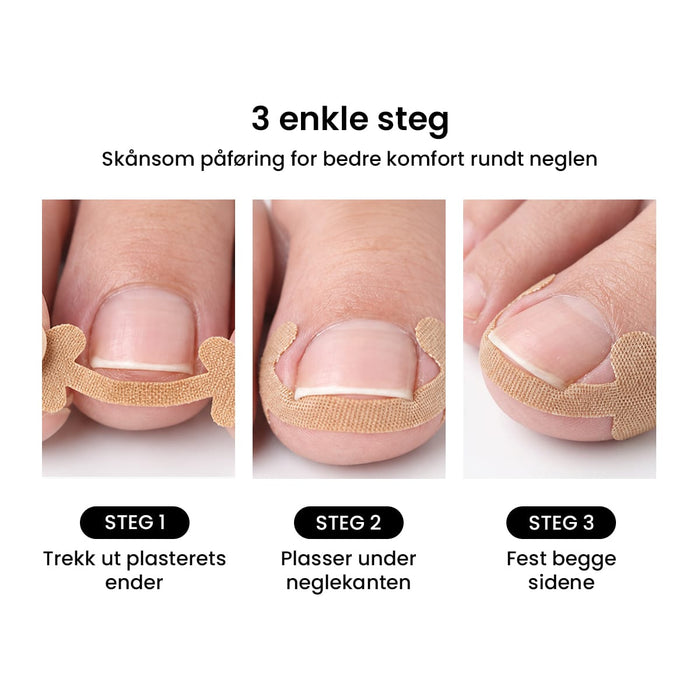 Plaster mot inngrodd negl (12 stk)