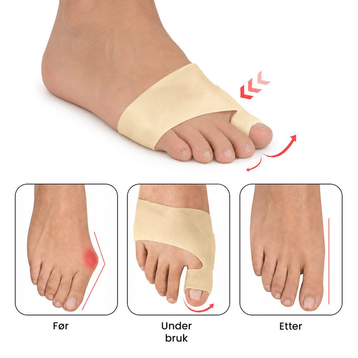 Gelstrømpe for hallux valgus
