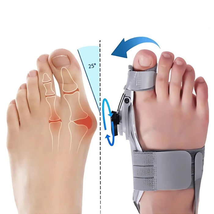 Kroppsbutiken Hallux valgus Hvit Hallux valgus-korrektor (justerbar)