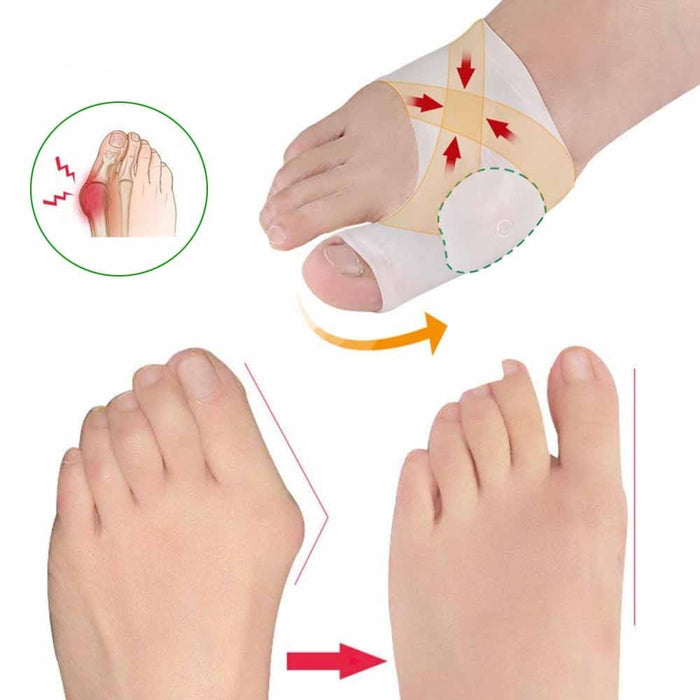 Kroppsbutiken Hallux valgus Standardtittel Gelstrømpe (hallux valgus)