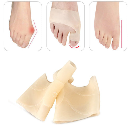 Kroppsbutiken Hallux valgus Standardtittel Gelstrømpe (hallux valgus)