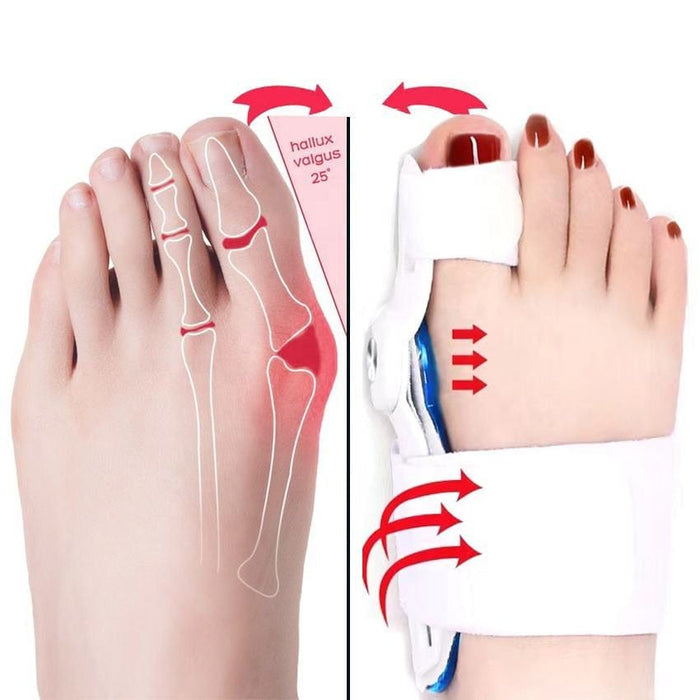 Kroppsbutiken Hallux valgus Standardtittel Hallux valgus nattstøtte (korrigerer)
