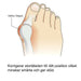 Kroppsbutiken Hallux valgus Standardtittel Hallux valgus silikonbeskyttelse