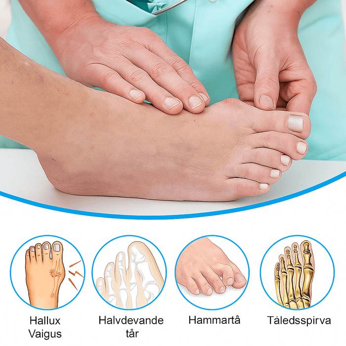 Kroppsbutiken Hallux valgus Standardtittel Hallux Valgus - Storetåspreder