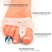 Kroppsbutiken Hallux valgus Standardtittel Mellomlegg Hallux valgus
