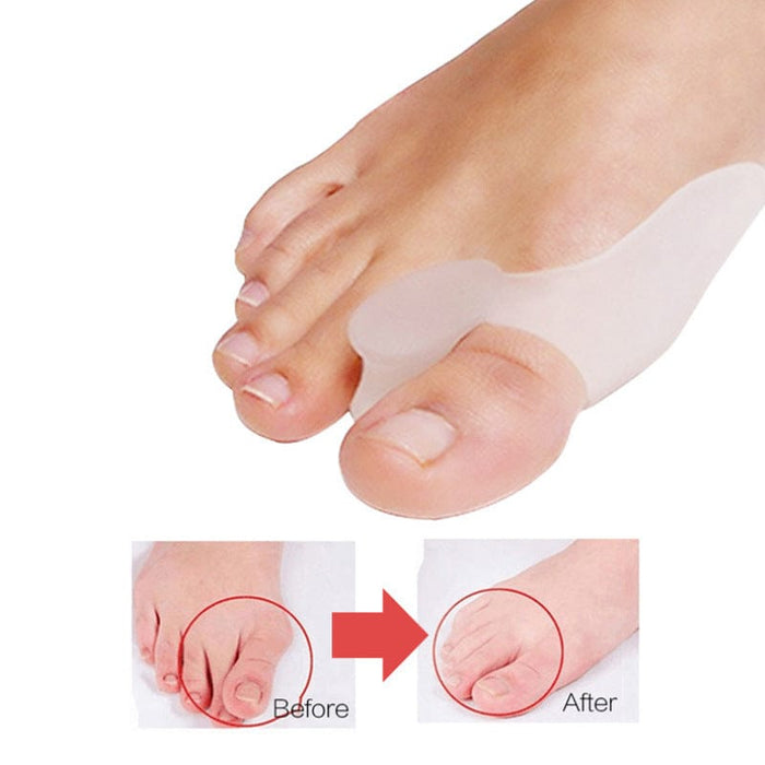 Kroppsbutiken Hallux valgus Standardtittel Tåskiller (hallux valgus, 2-pakning)